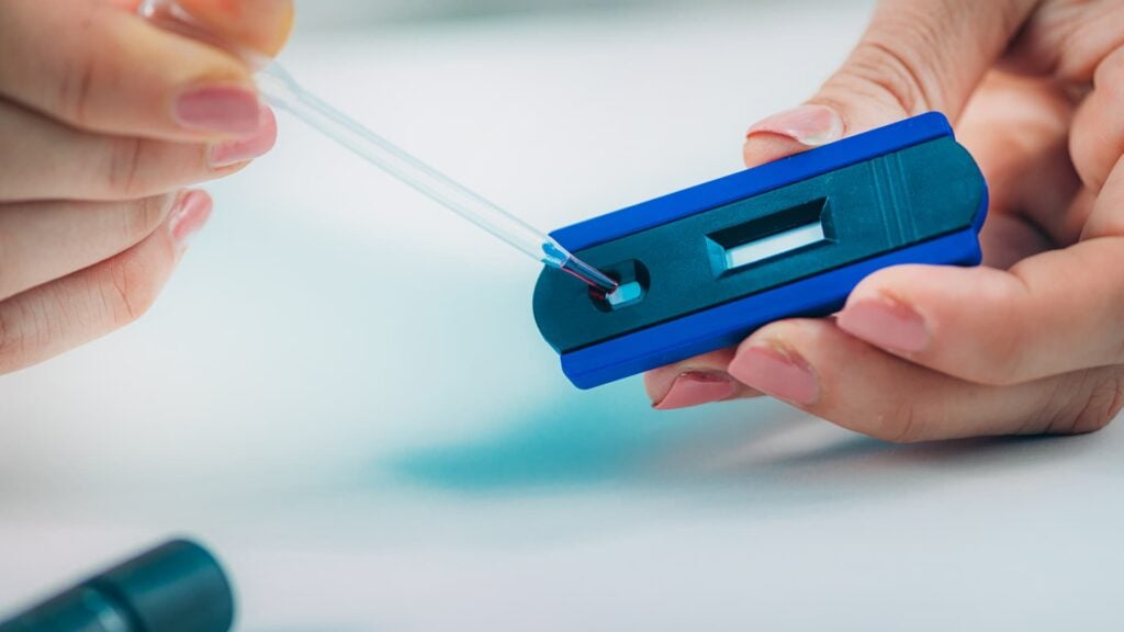 Antibody Blood Testing in Chiang Mai Antibody Blood Testing in Chiang Mai