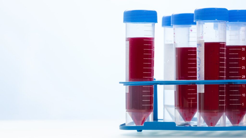 Trusted Allergy Screening Blood Test Provider Trusted Allergy Screening Blood Test Provider
