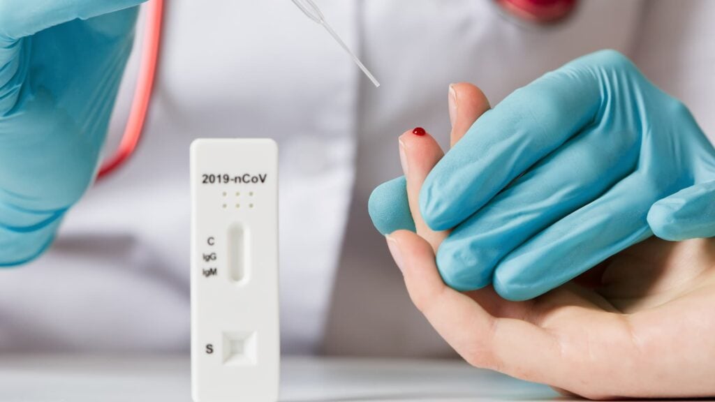 affordable price immunology test affordable price immunology test