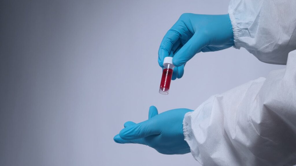 covid 19 antibody test service in chiang mai covid 19 antibody test service in chiang mai