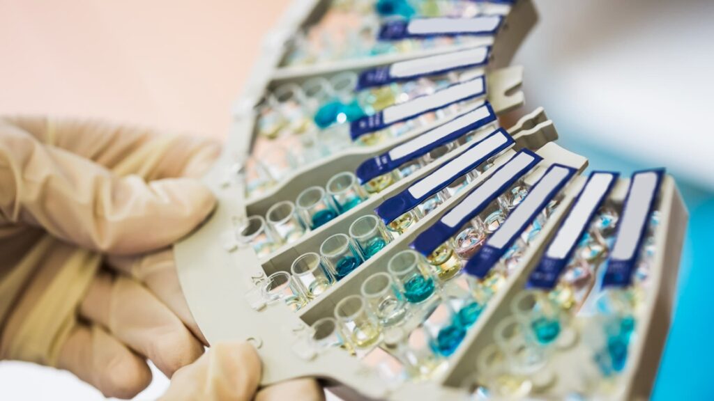 immunoglobulin g antibody screening test immunoglobulin g antibody screening test