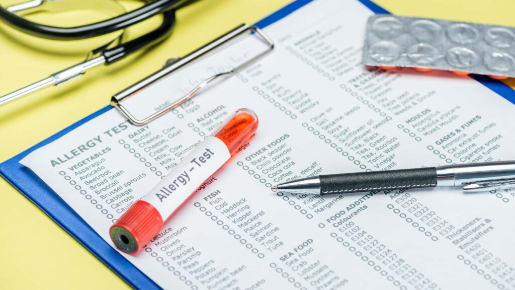 the best ige test in chiang mai the best ige test in chiang mai